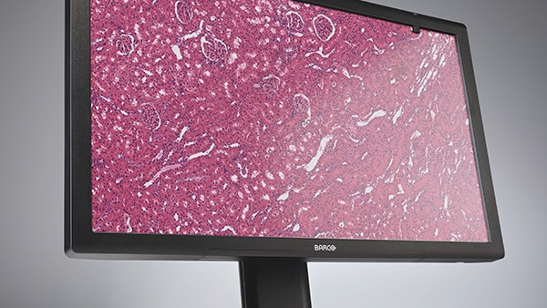 Barco MDPC-8127 Pathology Display Video